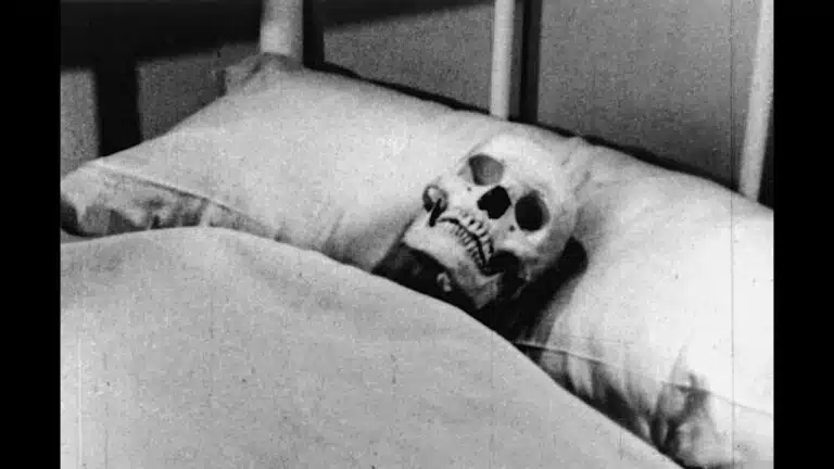 A skeleton lies in a hospital bed
