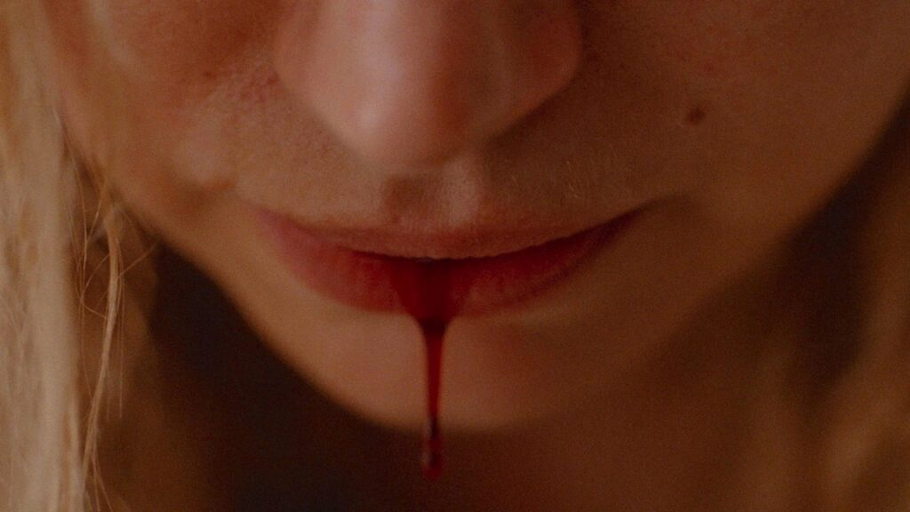Close up of Lidia's lip bleeding