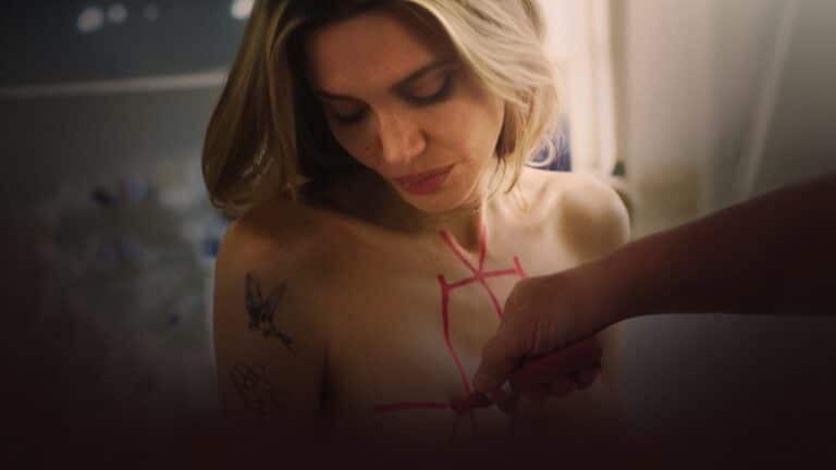 Maxine is marked up with a pen for her operation