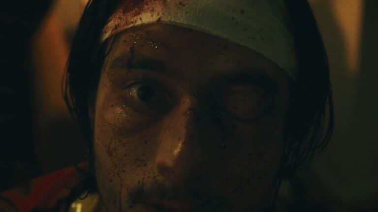 Close-up of Ricky's bandaged head