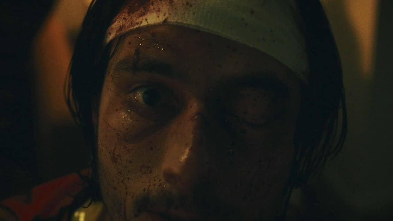 Close-up of Ricky's bandaged head